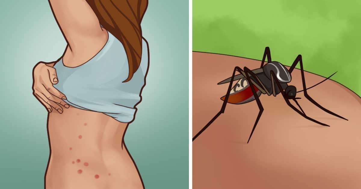 Formas fáciles de aliviar a los mosquitos sin usar DEET o loción de calamina